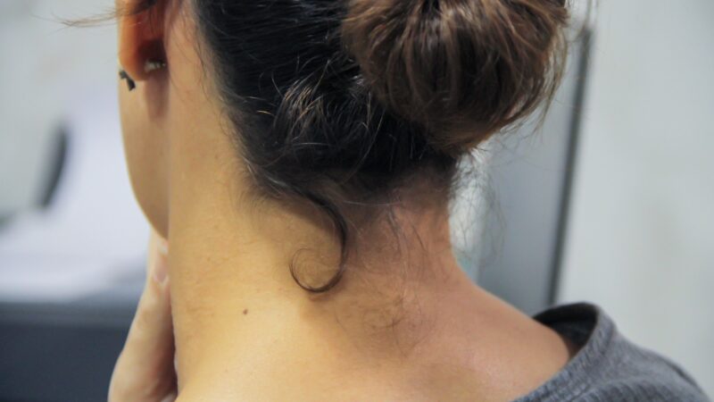 Câncer de cabeça e pescoço: legislação alerta população para diagnóstico precoce