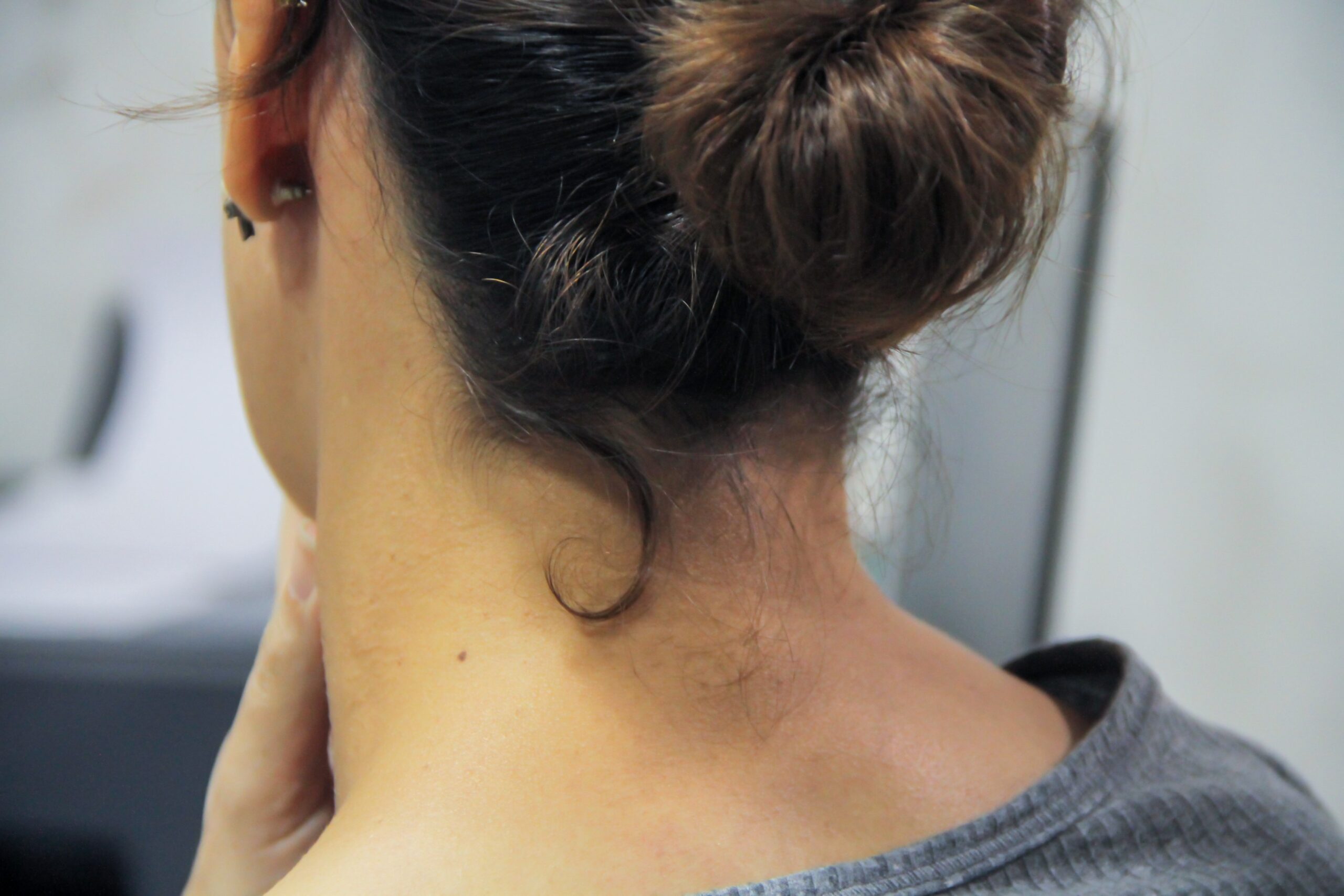 Câncer de cabeça e pescoço: legislação alerta população para diagnóstico precoce